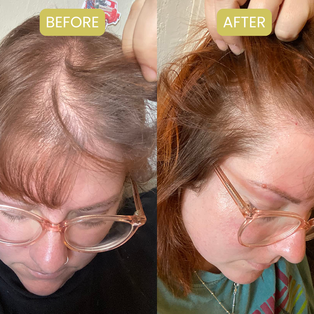 Hair & Skin Gummies